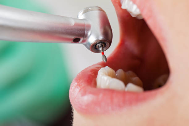 Best Emergency Treatment for Dental Infections or Abscesses in Geneva, AL
